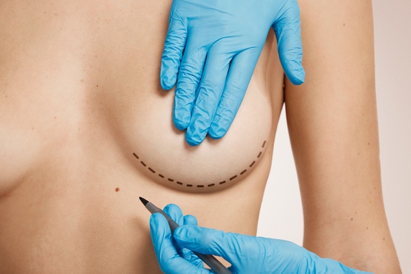 Breast Reduction London